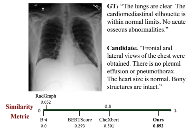 Image for Image-aware Evaluation of Generated Medical Reports,